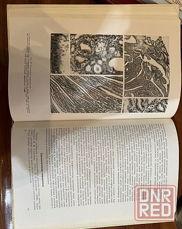 Книга по дерматологии "Эпителиальные опухоли" Донецк - изображение 3
