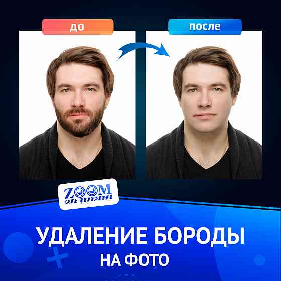 Удаление бороды Донецк