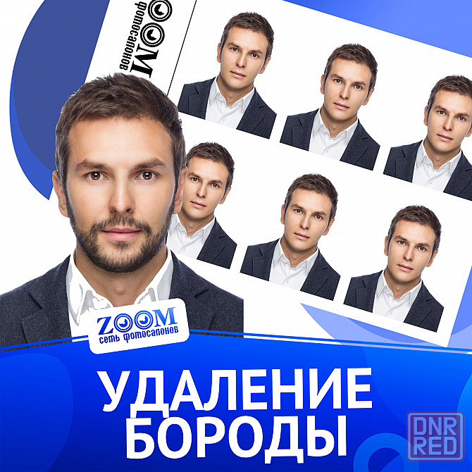 Удаление бороды Донецк - изображение 1