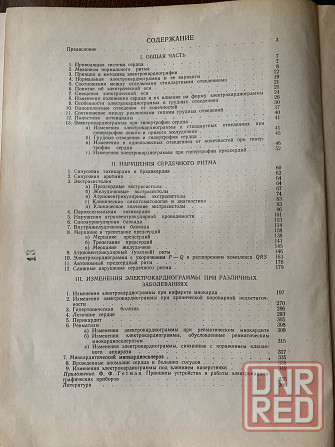 Основы электрокардиологии, анализ и клиническая оценка электрокардиограммы Донецк - изображение 7