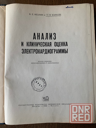 Основы электрокардиологии, анализ и клиническая оценка электрокардиограммы Донецк - изображение 6
