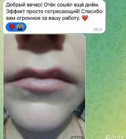 Лазерное удаление Донецк Донецк
