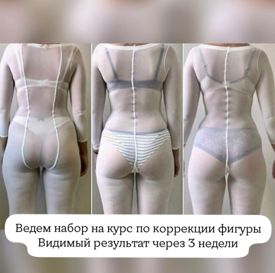 Коррекция фигуры | Косметология | Лазерная эпиляция | Массаж Донецк