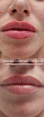 Коррекция фигуры | Косметология | Лазерная эпиляция | Массаж Донецк