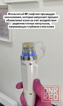 Рф-игольчатый/смас/Liposonix/Макеевка/днр Макеевка - изображение 1