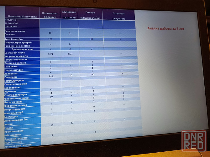 Безоперационное лечение тромбофлебита, геморроя и др. Мариуполь - изображение 1