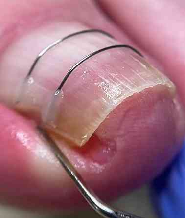 Подолог - есть выезд на дом Донецк