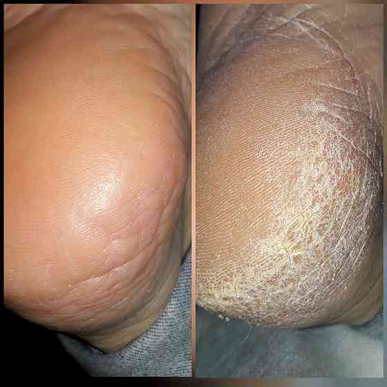 Аппаратный маникюр, гель лак ,Smart педикюр Донецк