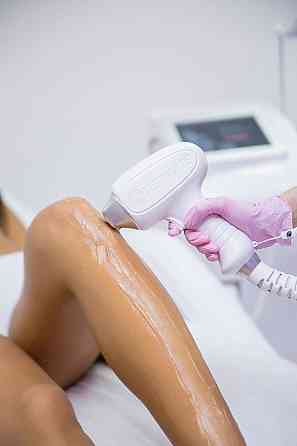 Лазерная эпиляция Мариуполь