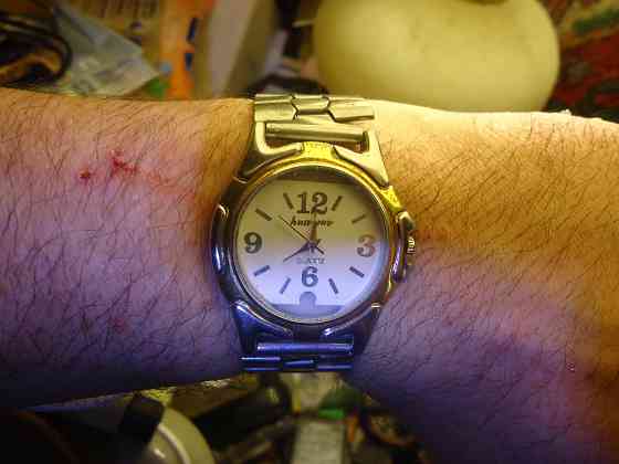 Дискомалярия, дискомалярия?! Донецк