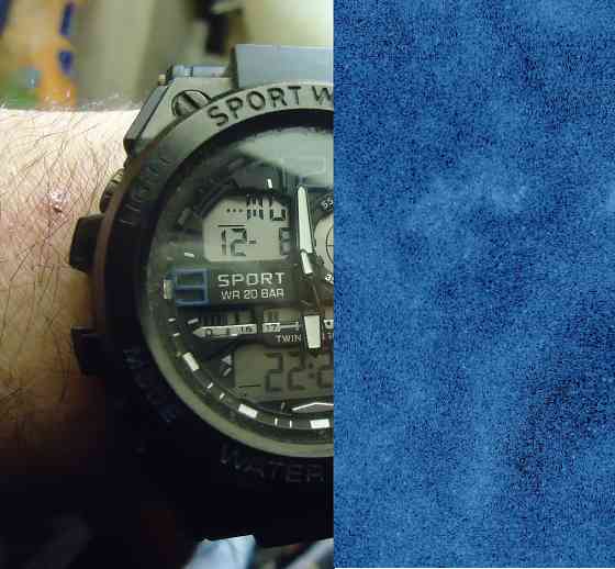 "Сталоне" ноги бёдрах дряблые' Донецк