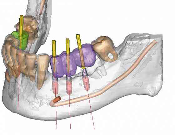 Семейная стоматология ""ваш стоматолог"" Донецк