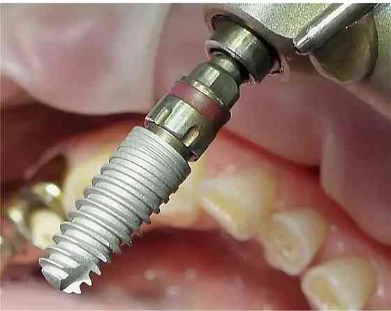 Семейная стоматология ""ваш стоматолог"" Донецк