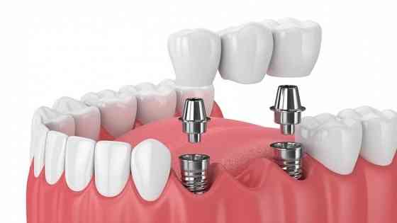 Семейная стоматология ""ваш стоматолог"" Донецк