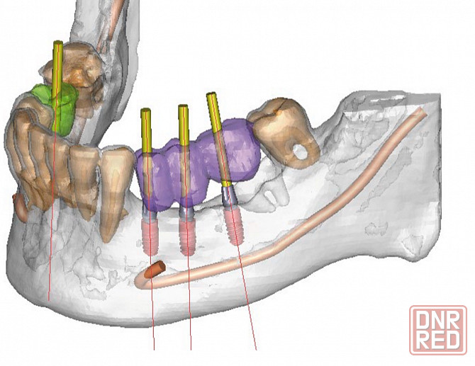 Семейная стоматология ""ваш стоматолог"" Донецк - изображение 6