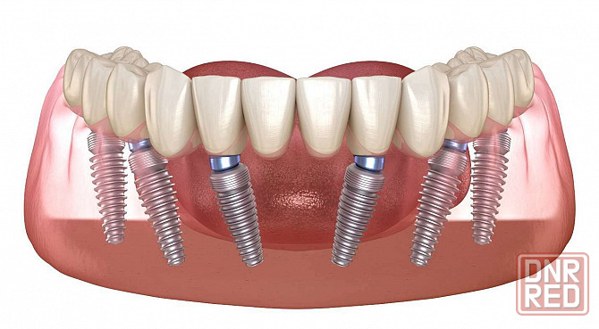 Семейная стоматология ""ваш стоматолог"" Донецк - изображение 4