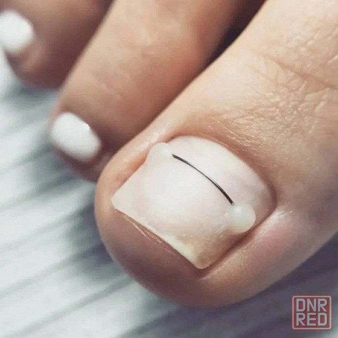 Подолог Донецк - изображение 1