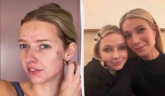 Шо это прохвесор всея Европы Донецк