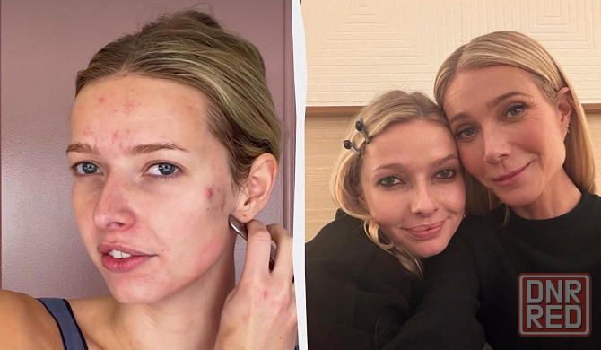 Шо это прохвесор всея Европы Донецк - изображение 1