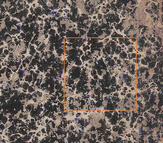 Нарколог "Тортов" переел 1872 Донецк