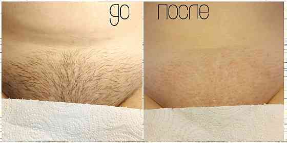 Услуга мастера по депиляции воском Макеевка