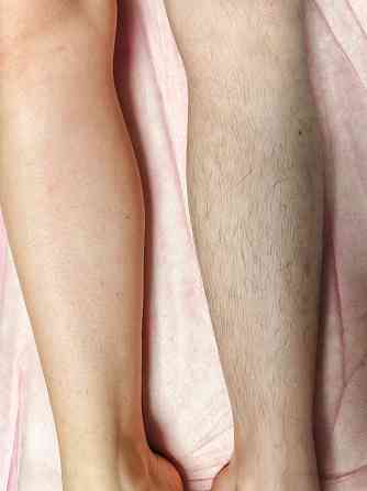 Услуга мастера по депиляции воском Макеевка