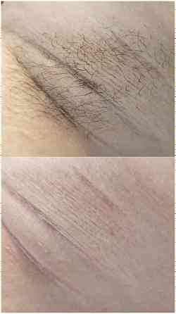 Услуга мастера по депиляции воском Макеевка