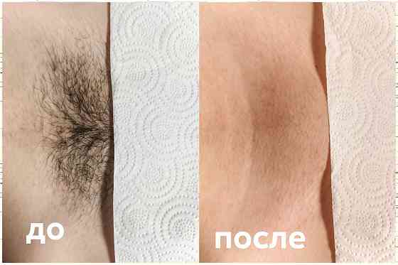 Услуга мастера по депиляции воском Макеевка