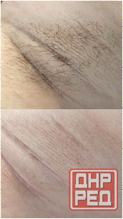 Услуга мастера по депиляции воском Макеевка - изображение 6