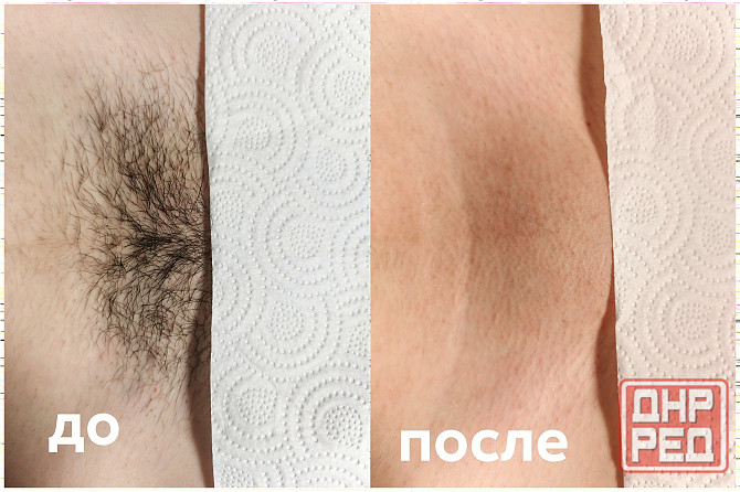 Услуга мастера по депиляции воском Макеевка - изображение 1