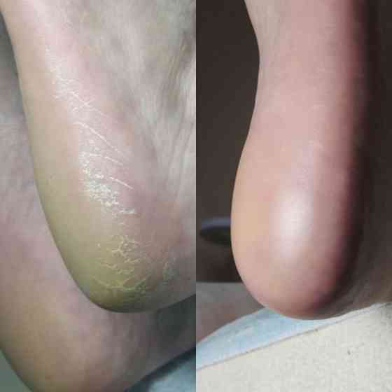 Маникюр,Педикюр,Макеевка Макеевка