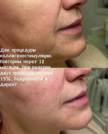 Косметолог Донецк