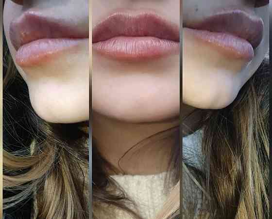 Косметолог Донецк