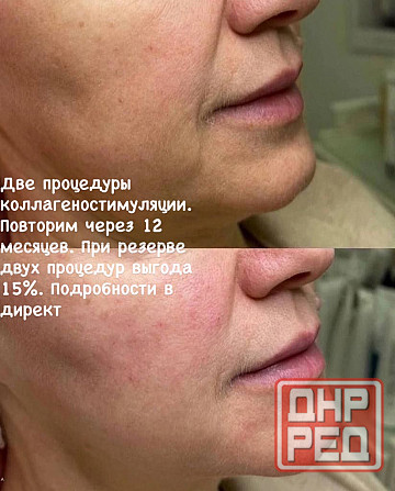 Косметолог Донецк - изображение 2