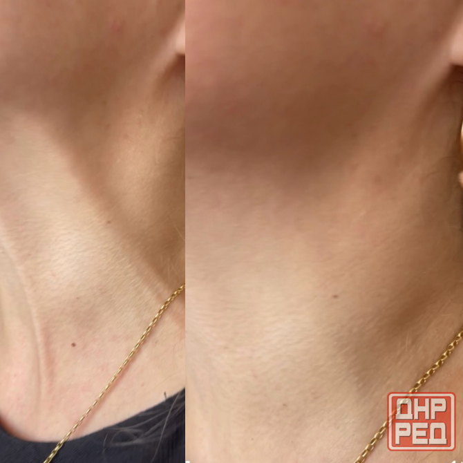 Косметолог Донецк - изображение 4