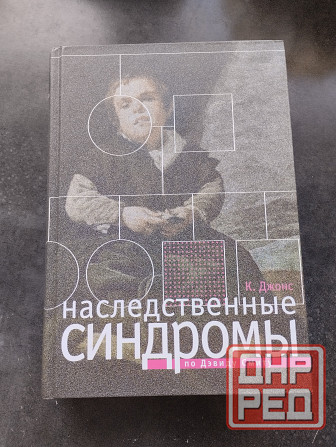 Наследственные синдромы книга по Дэвиду Смиту Донецк - изображение 1