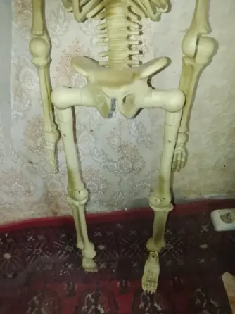 Скелет Сша Донецк