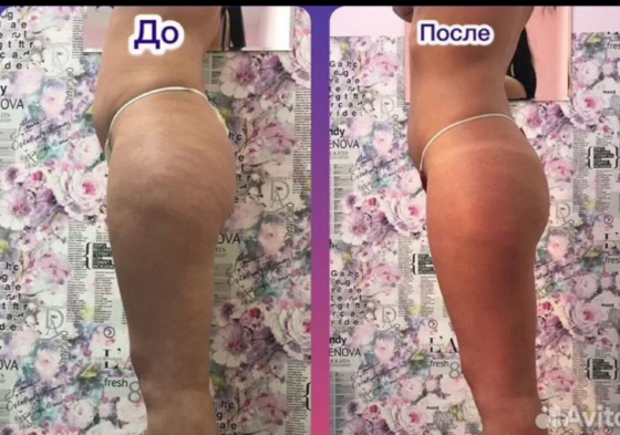 Массаж Донецк