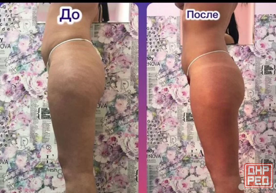 Массаж Донецк - изображение 2