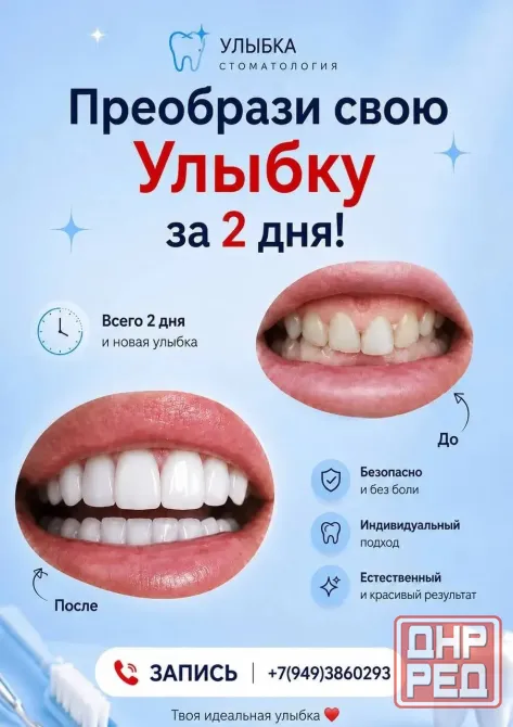 Преобрази свою улыбку Донецк - изображение 1