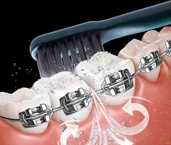 Зубная щетка электрическая со стерилизатором Xiaomi T-Flash UV Sterilization Toothbrush (зеленая) Макеевка