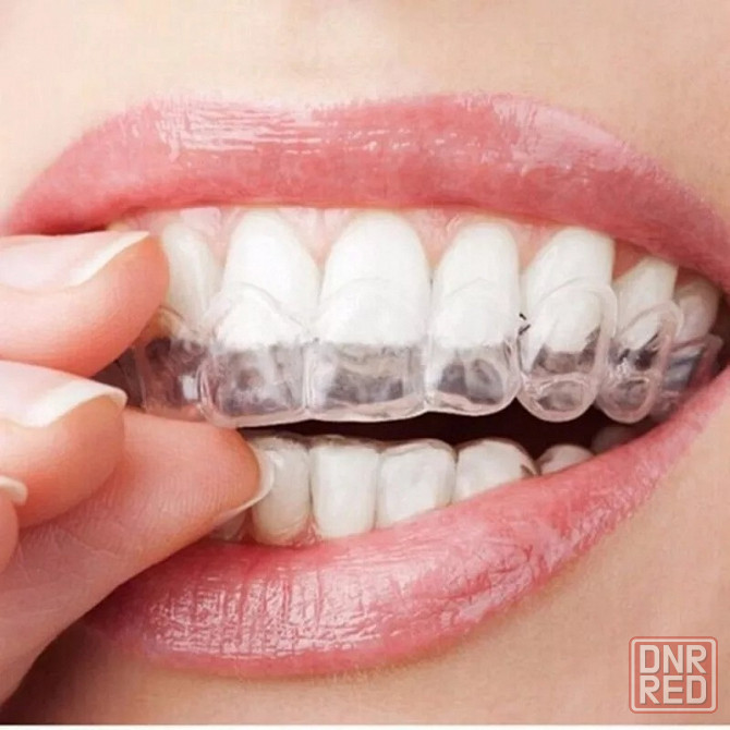 Отбеливающие полоски для зубов | 5D WHITE TEETH | Отбеливание зубов Донецк - изображение 3