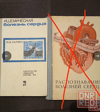 Медицинская литература. Кардиология Донецк - изображение 5
