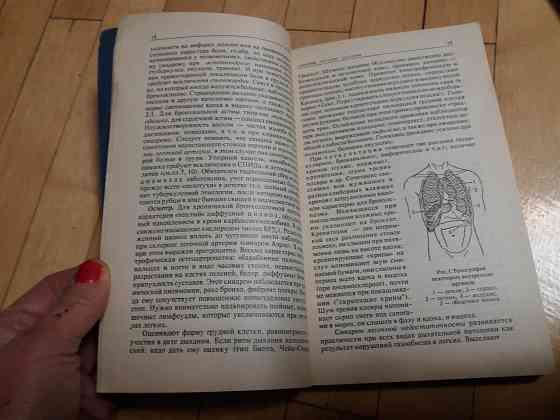 книги медицина "внутренние болезни" Донецк