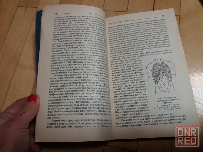 книги медицина "внутренние болезни" Донецк - изображение 6
