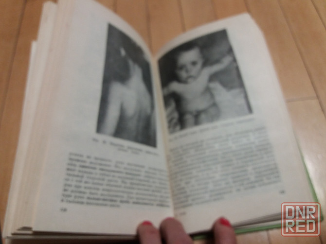 Медицинские книги справочник акушера-гинеколога и родовые повреждения нервной системы" Донецк - изображение 3