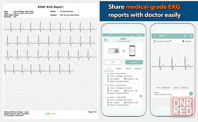 Портативный ЭКГ Bluetooth-монитор Электрокардиографии EMAY EMG-2 Запорожье - изображение 7