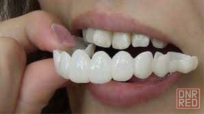 Виниры, с которыми Вы захотите улыбаться! Запорожье - изображение 3