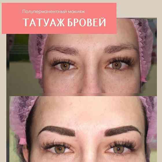 Косметолог Запорожье. Увеличение губ, мезотерапия, татуаж Запорожье