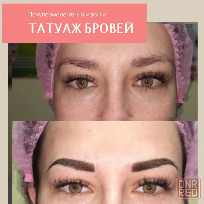 Косметолог Запорожье. Увеличение губ, мезотерапия, татуаж Запорожье - изображение 2